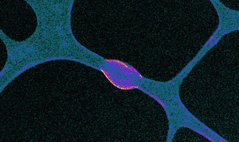 Wetting at the nanoscale