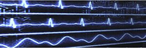 Photonic monitoring of physiology