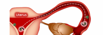 Uterus