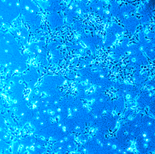 Microphotography of live young neurons, derived from human stem cells, growing on a synthetic matrix produced at nanoGUNE.