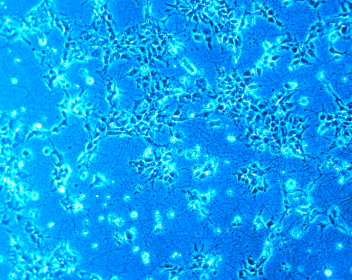 Microphotography of live young neurons, derived from human stem cells, growing on a synthetic matrix produced at nanoGUNE.