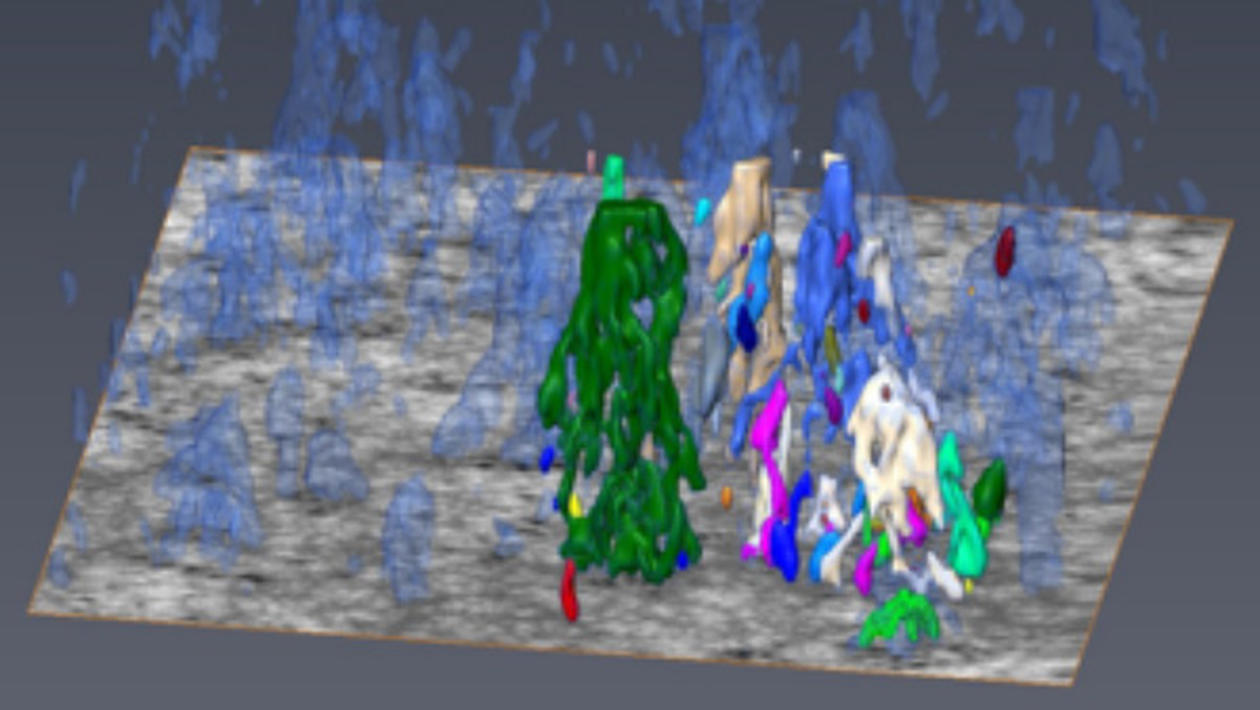 Micro/Nano Tomography, 3D electron microscopy