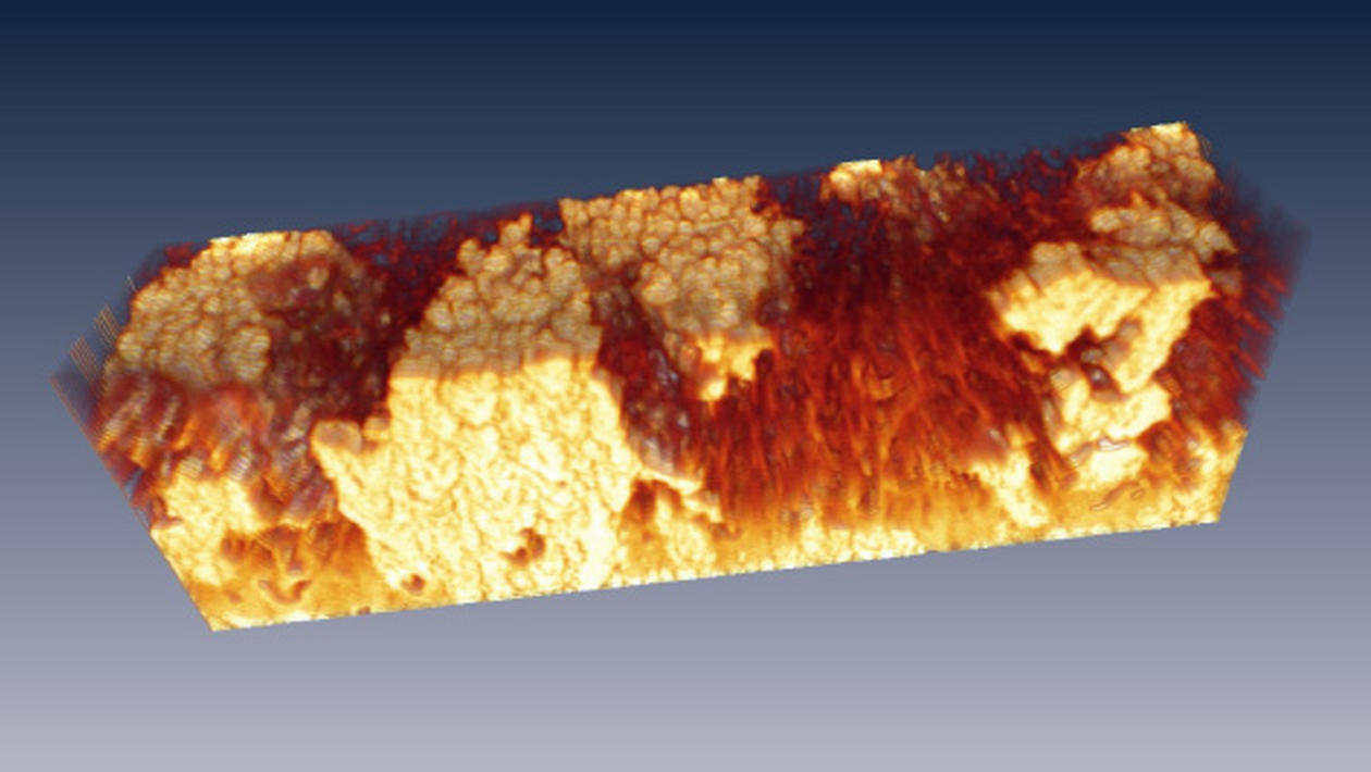 Micro/Nano Tomography, 3D electron microscopy